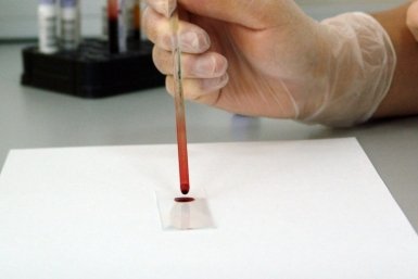 Тематическое фото pxhere.com