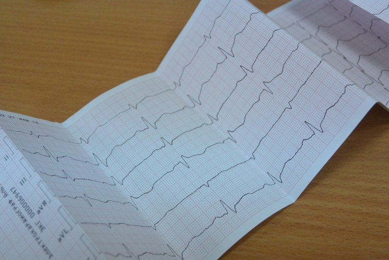 Кардиограмма ИА ЕАОMedia