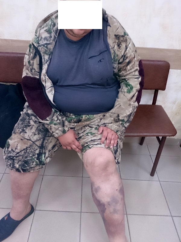 Следы побоев на теле задержанного, Фото с места события из других источников