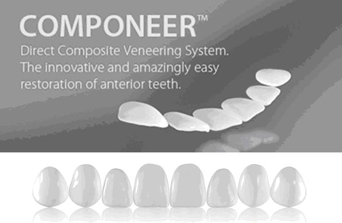 Фабрично изготовленные тонкие виниры COMPONEER от швейцарской компании COLTENE